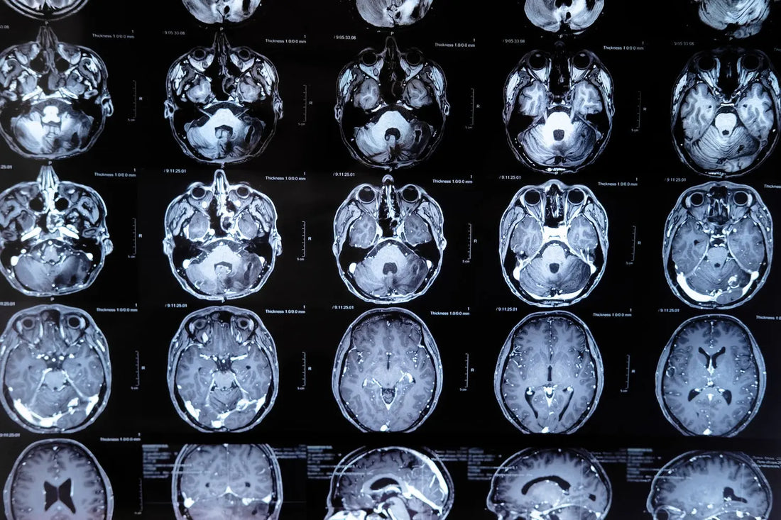 What is Transcranial Current Stimulation (tACS)? Benefits Of tACS On Brain Health