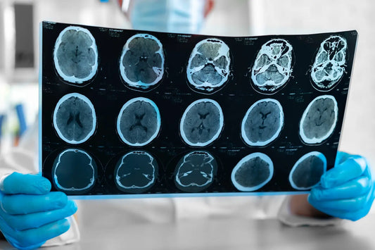 How does Audio Visual Entrainment benefit TBI?