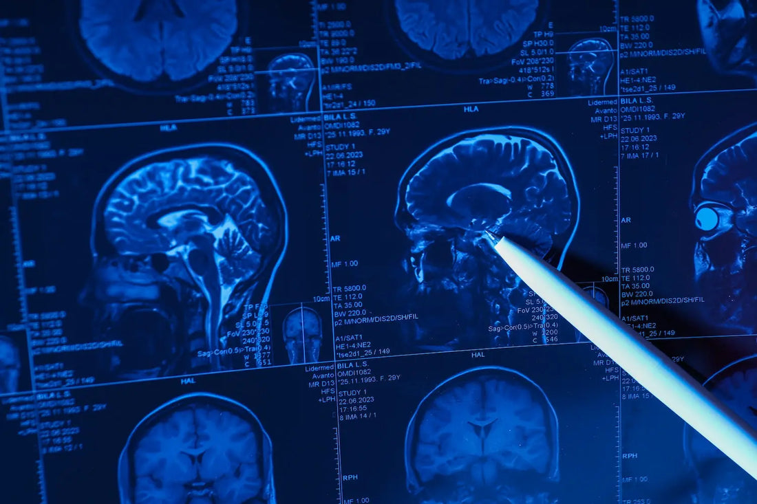 Does Audio-visual Entrainment Work for Parkinson's Disease? Scientific Explanation.
